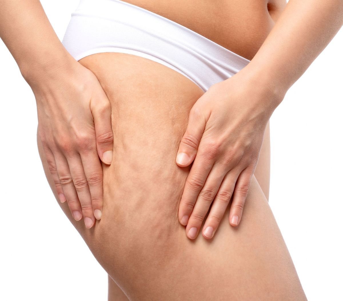 INTRADERMOTERAPIA PARA FLACIDEZ